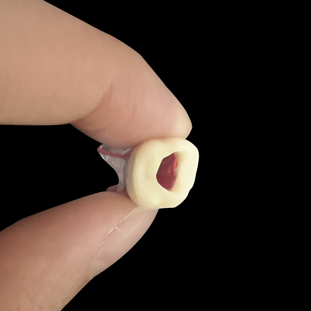 Dental Endo Teeth Root Canal Study Model RCT Practice Block Pulp Cavity ...