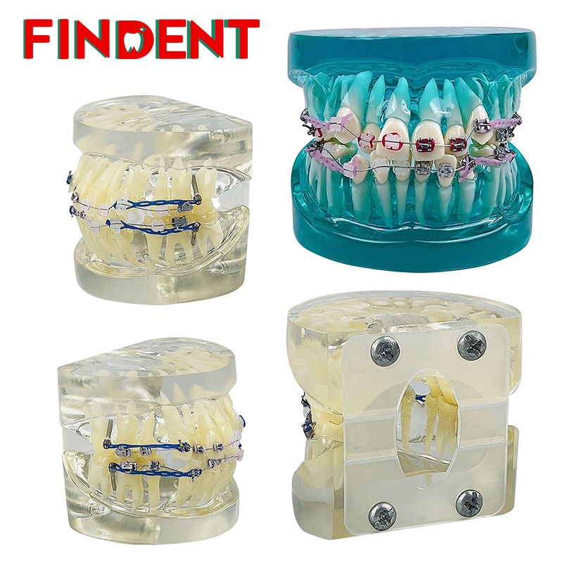Dental Teeth Model With Braces Archwire Gum Tooth Resin Dentistry