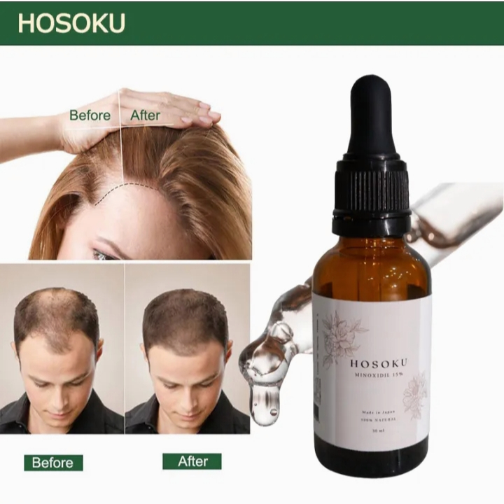 Minoxidil 15% Hosoku Hair Growth(with collagen and castor oil) Hair ...