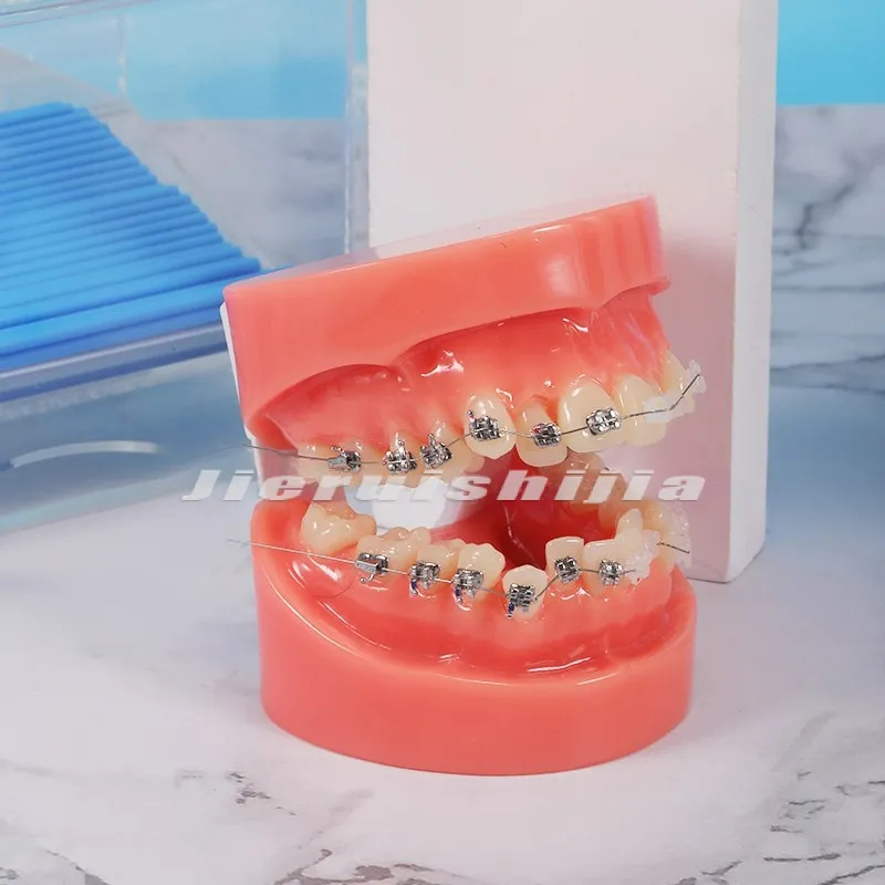 Oral Malocclusion teaching ceramic Model Dental Teeth Orthodontic Model