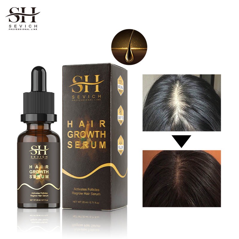 SEVICH Ginger Hair Growth Serum Anti-Hair Loss Essence 20ml | Shopee ...