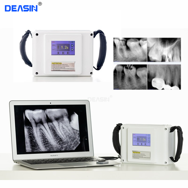 Dental x ray Unit xray Portable Machine Dental x-ray Equipment Opg ...