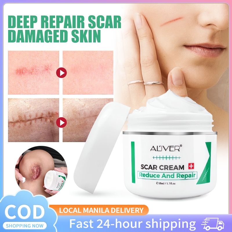 Image showcasing ALIVER Old Scar Remover Cream For Legs Peklat Remover Acne Treatment ...