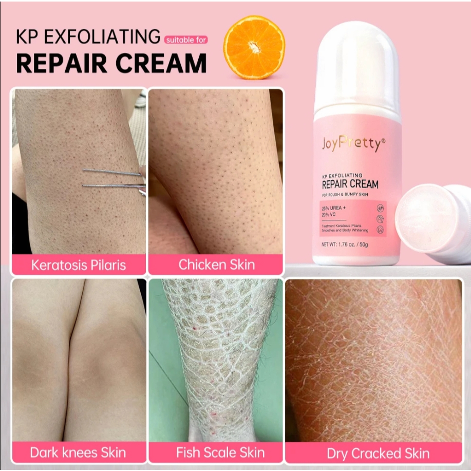 Body Cream Chicken Skin Removal Treatment Keratosis Pilaris Lotion