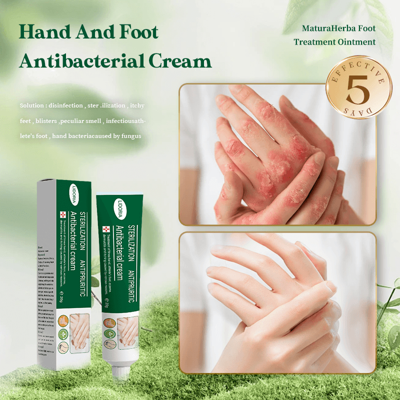 Anti Fungal Skin Fighter Cream Original For Itchi Skin Herbal Eczema ...