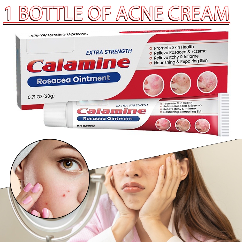 Calamine Rosacea Ointment Acne Repair Face Soothing Cream Pimple