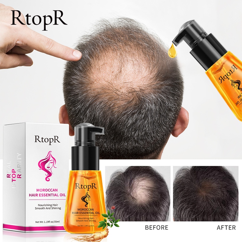 RtopR FDA Moroccan Prevent Hair Loss Product Hair Growth Essential ...