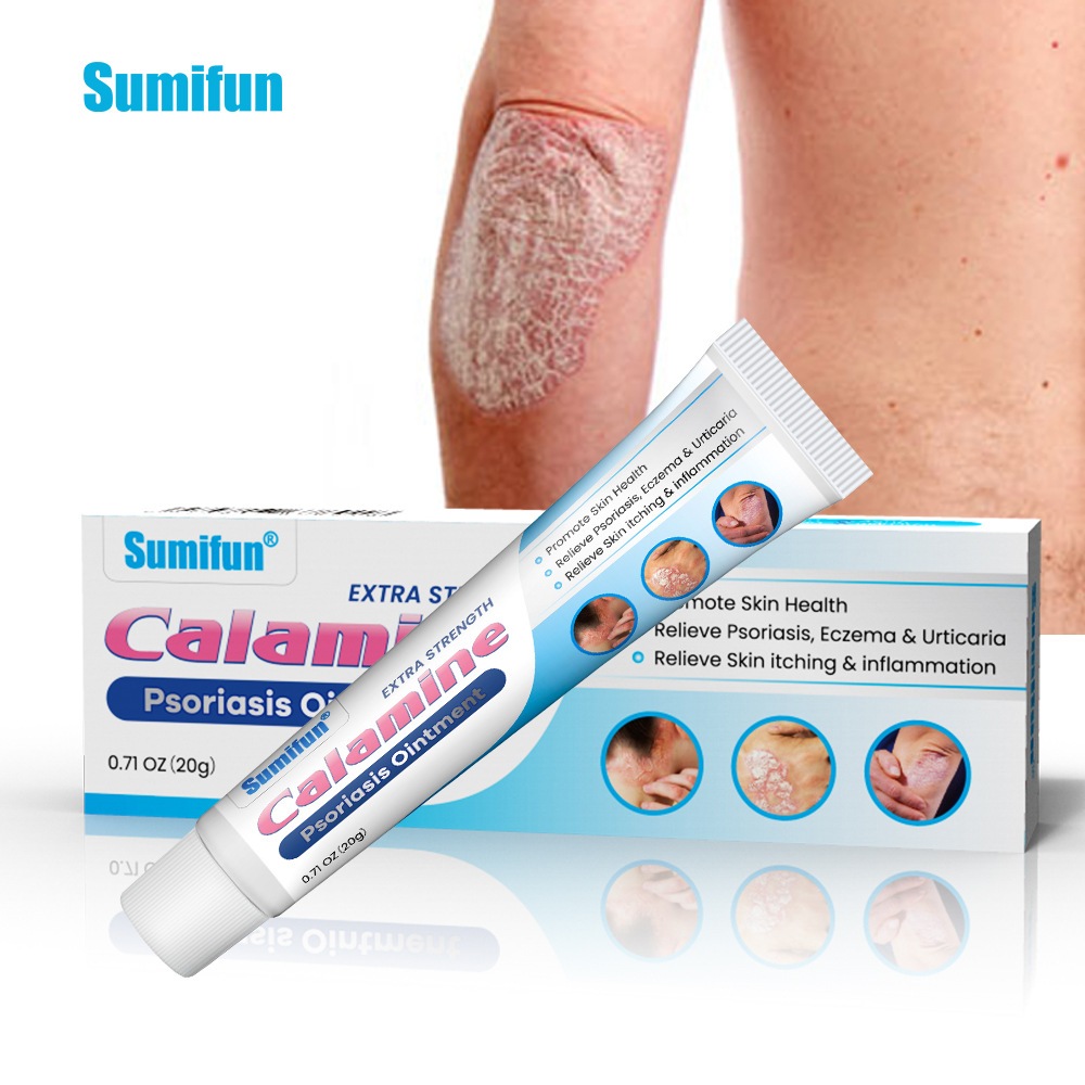 Calamine Psoriasis Ointment Eczema Cream Anti-Itch Dermatitis Pruritus ...