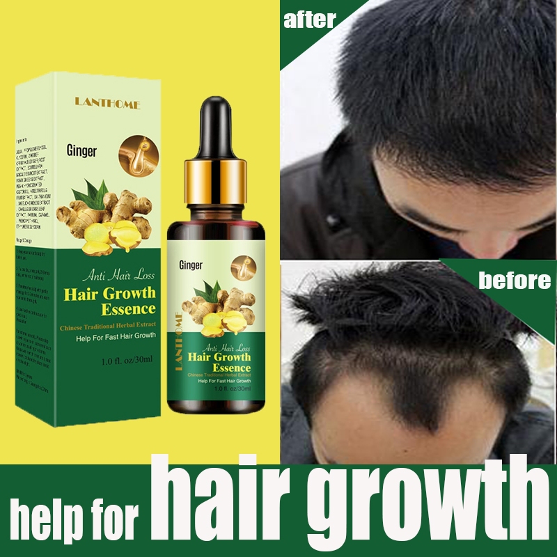 LANTHOME Hair Growth Essence Anti Hair Loss stronger Non-sticky ...