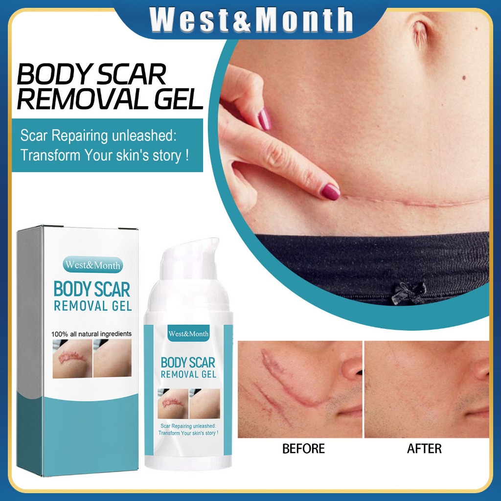West&Month Scar Removal Gel Scar Repair Lotion Cesarean Section Scar Smoothing Scar Skin Care