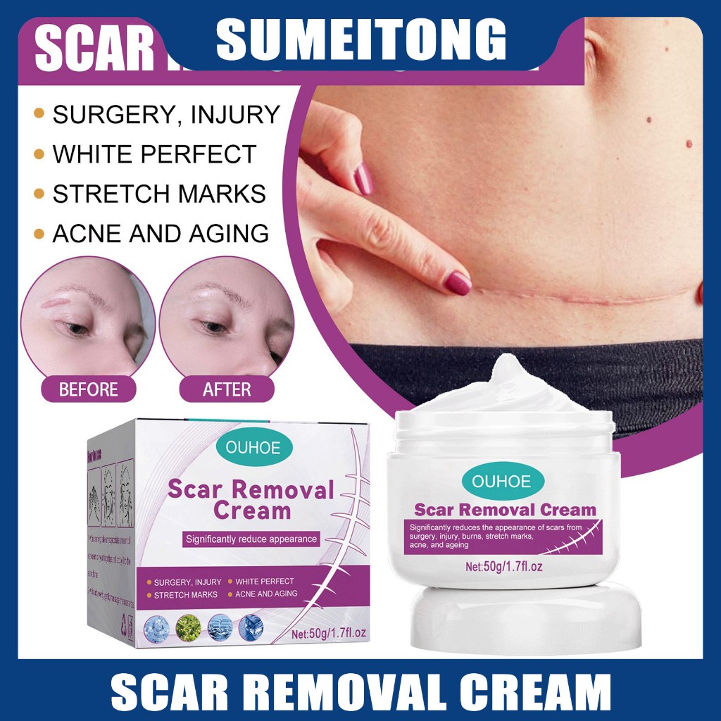 OUHOE Scar Removal Cream Repair Scars Operation Scald Cream Dermatix