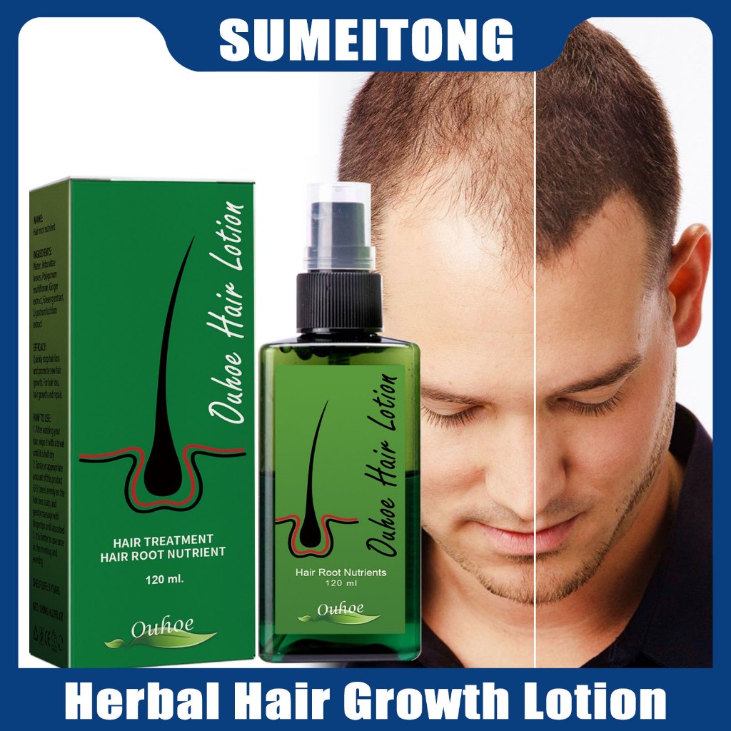 Ouhoe Hair Growth Lotion 100ML Herbal Anti Hair Loss Spray Treatment ...