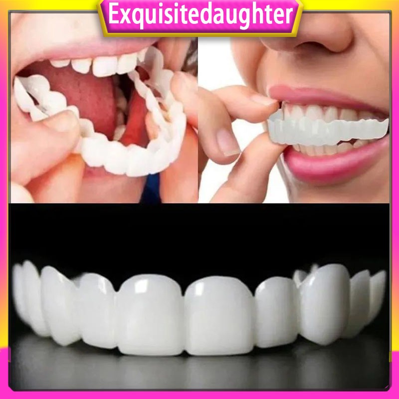 Upper and lower teeth simulation braces Whitening braces sixth ...