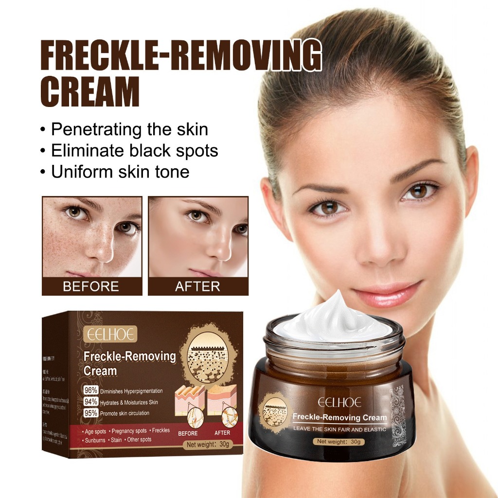 EELHOE Freckle-Removing Cream Retinol Whitening Lotion Remove Melasma ...