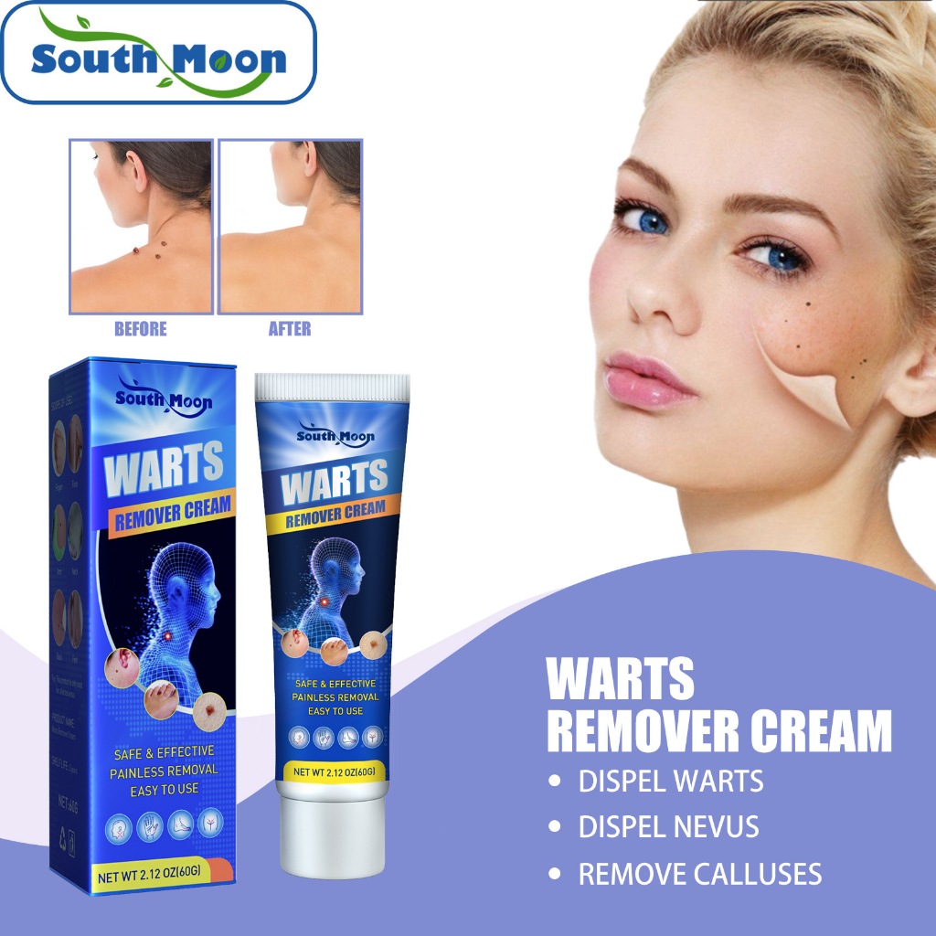 South Moon Wart Cream, Hands, Feet, Face Skin, Armpits, Flesh, Neck ...