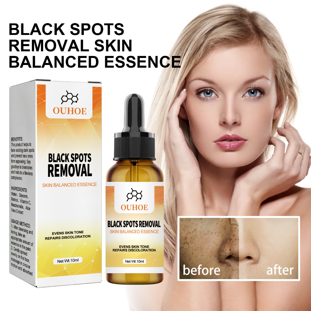 Ouhoe Black Spots Removal Skin Balanced Essence Skin Brightening Serum ...