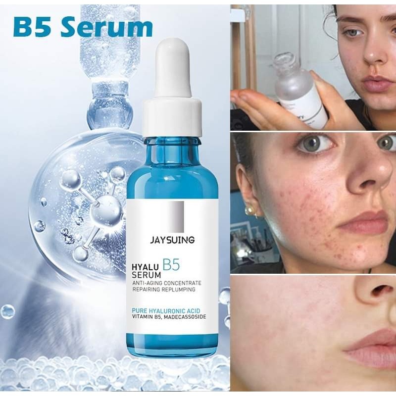 Jaysuing Hyalu B5 Serum Anti-wrinkle Concentrate - Anti-aging And Fine  Lines (30ml) cod | Shopee Philippines