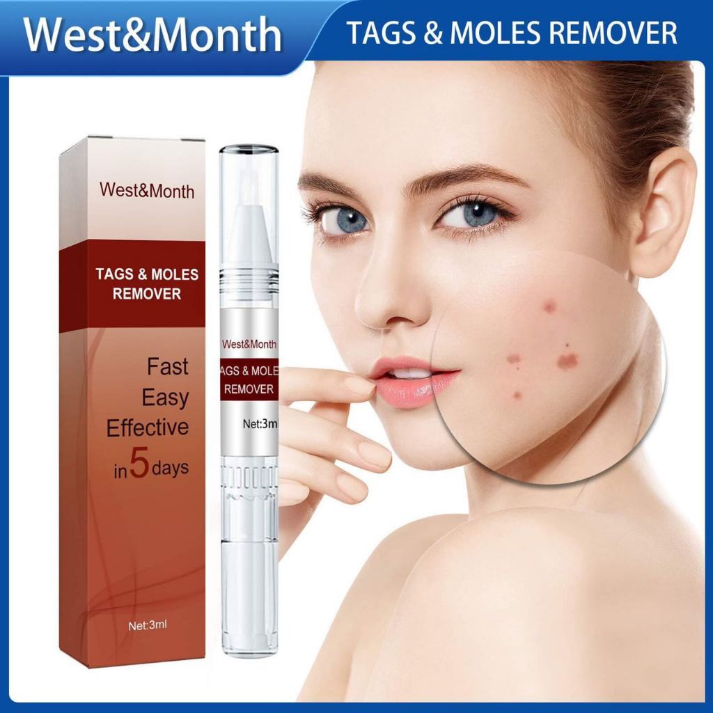 West Month Tags Moles Remover Pen Mole Remover Tags Remover Warts 3ml ...