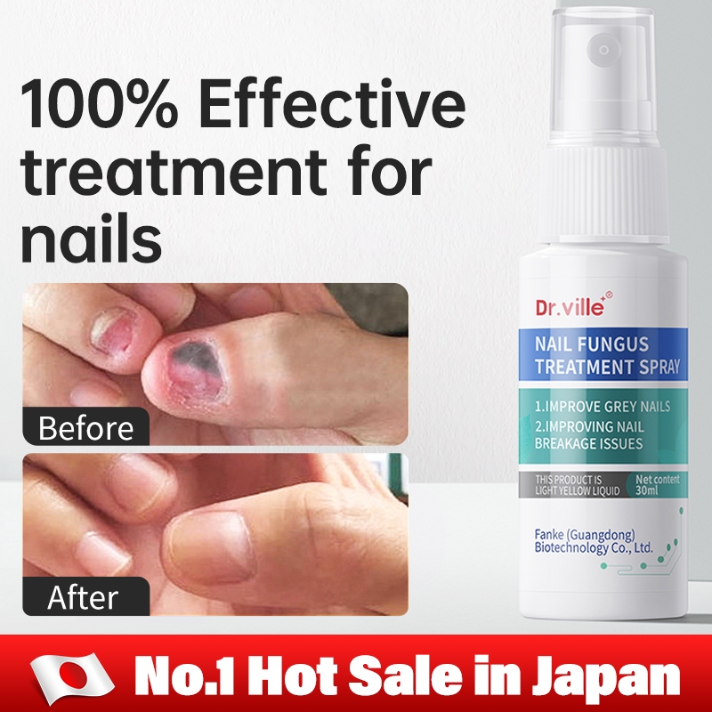 Anti Fungal Cream for Nail Antibacterial Nail Treatment Essential Spray ...