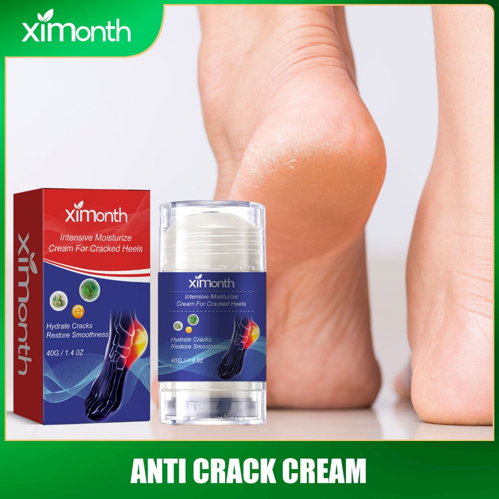 Ximonth Severe Cracked Heel Repair Restoring Balm Heel Repair Cream ...