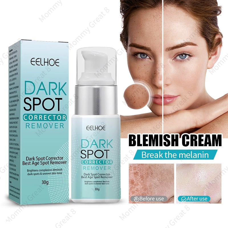 Melasma Cream Pekas Dark Spot Remover Original Collagen Pekas And Freckles Remover Whitening Cream