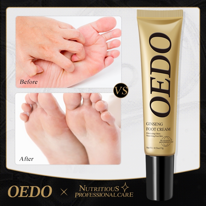OEDO Ginseng Nail Antifungal Treatments Cream Removal Nail Fungus Toe Anti Infection Foot Care