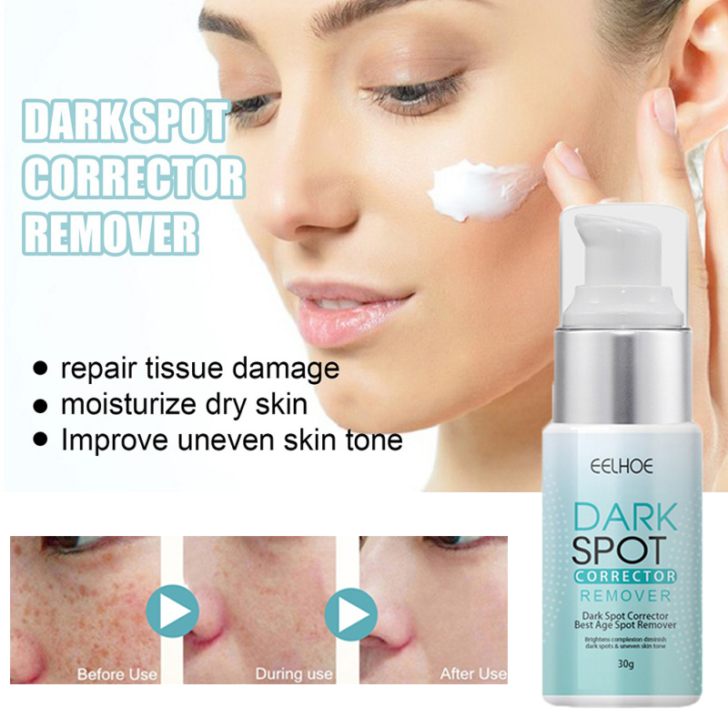 BUY 1 TAKE 1 Melasma Cream Pekas Dark Spot Remover Original Collagen ...