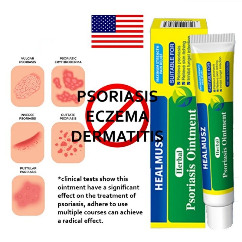 Healmusz Psoriasis Cream Psoriasis Ointment Dermatitis Eczema Cream 20g 