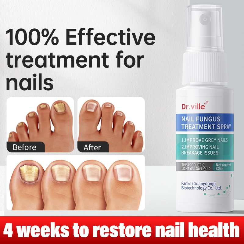 Yeast Infection Nail fungus treatment Ingrown Toenail Drops Essential