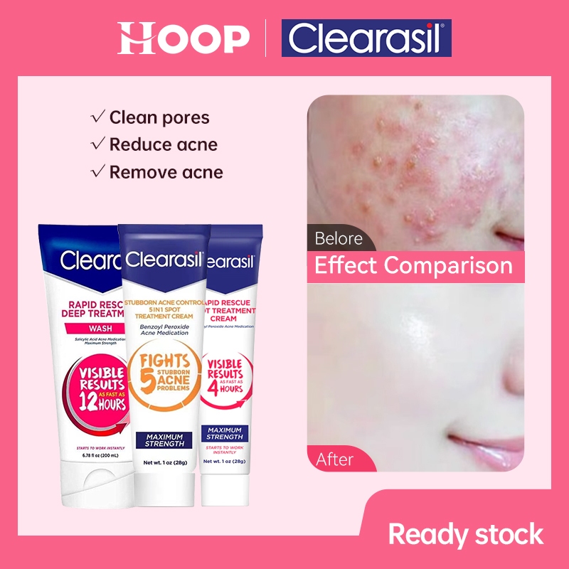 Reckitt Clearasil salicylic acid facial cleanser quickly and effectively removes acne and acne