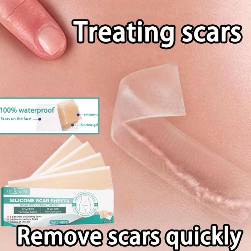 Scar patch medical silicone repair patch hyperplasia 10 billion ...