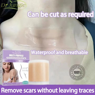 Silicone gel scar tape scar patch medical planing scar burn surgery ...