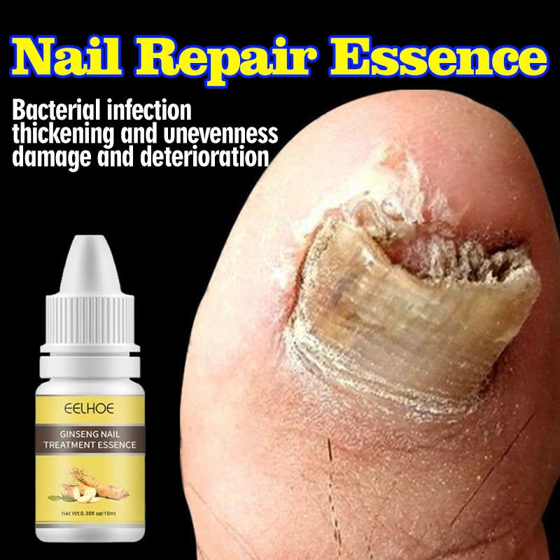 EELHOE Nail Repair Essence Serum Fungal Nail Treatment Anti Fungal Nail