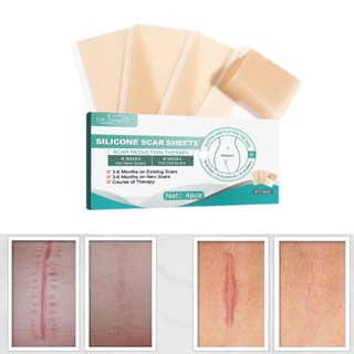 Scar patch medical silicone repair patch hyperplasia 10 billion ...