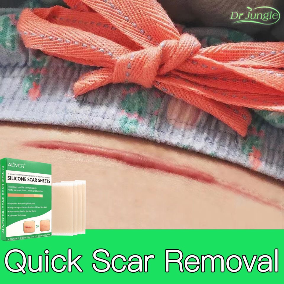 【Genuine】ALIVER Removal Patch Medical Grade Old Injury Scars Burns ...