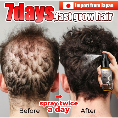 Japan Minoxidil Hair Grower Original Hair Treatments Anti Hair Loss for ...