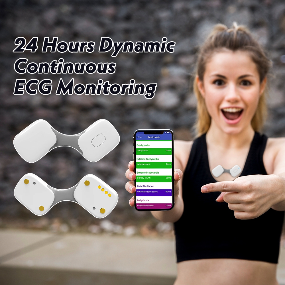 24-hour ECG monitor Portable wearable wireless electrocardiogram ...