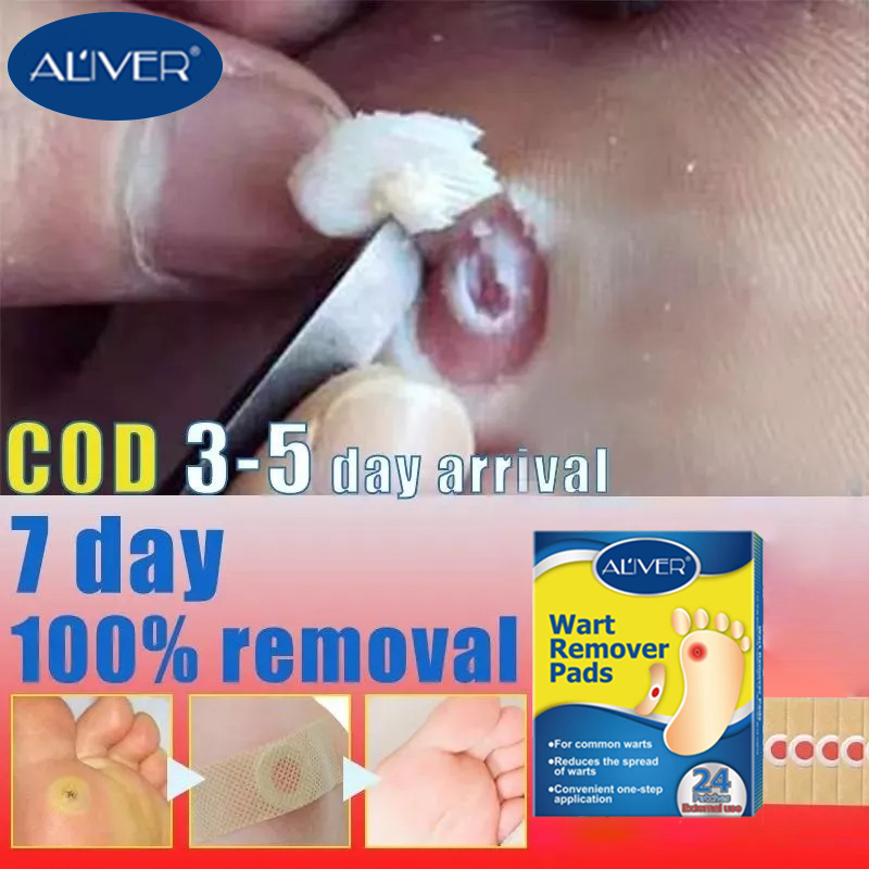 [READY STOCK] Remove Corns Stickers 24 Pcs Plantar Patches Feet Removal ...