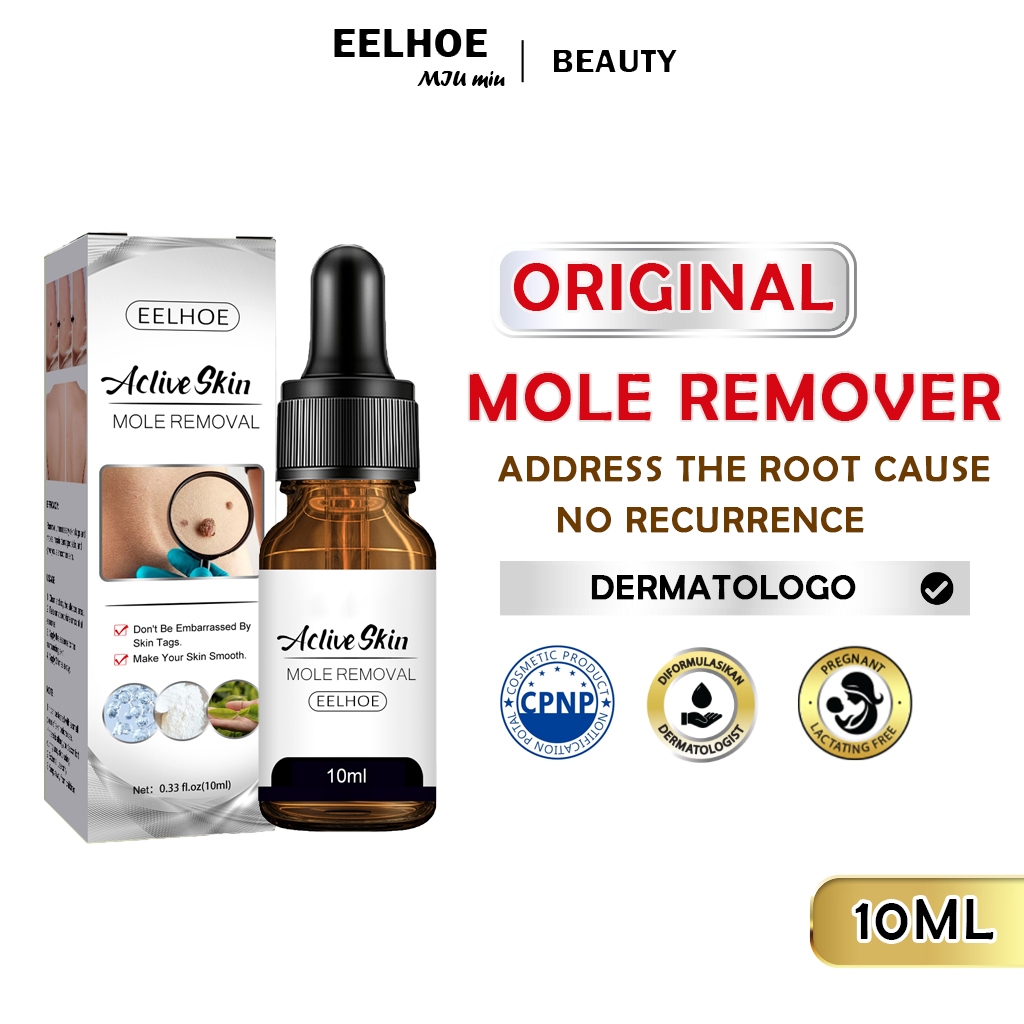 warts remover original 10ml kulugo remover mole remover skin tag ...
