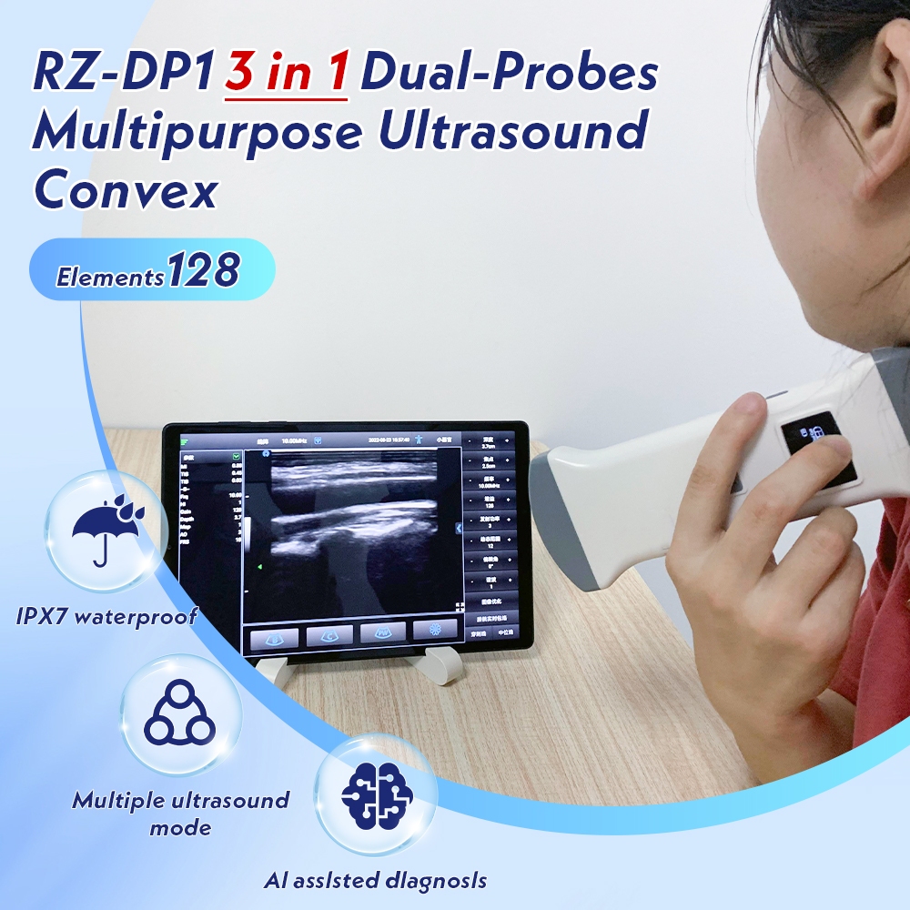 RZ-DP1 Dual-Probes Multipurpose Ultrasound Convex +Linear+ Cardiac ...