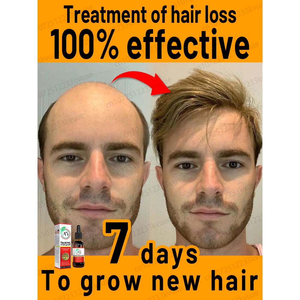 Hair growth essence, hair growth oil, promotes hair growth, nongreasy