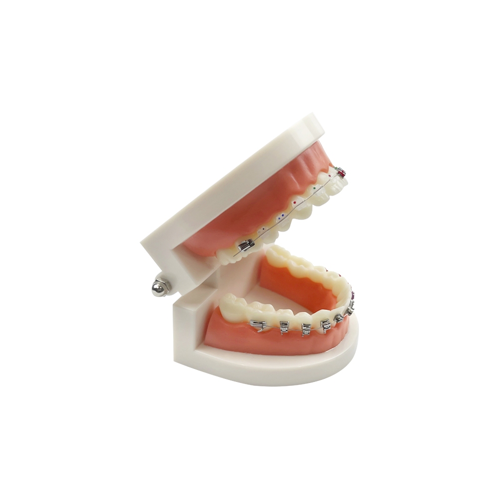 1Pcs 1/4 Self-Locking Dental Orthodontic Treatment Teeth Model With ...