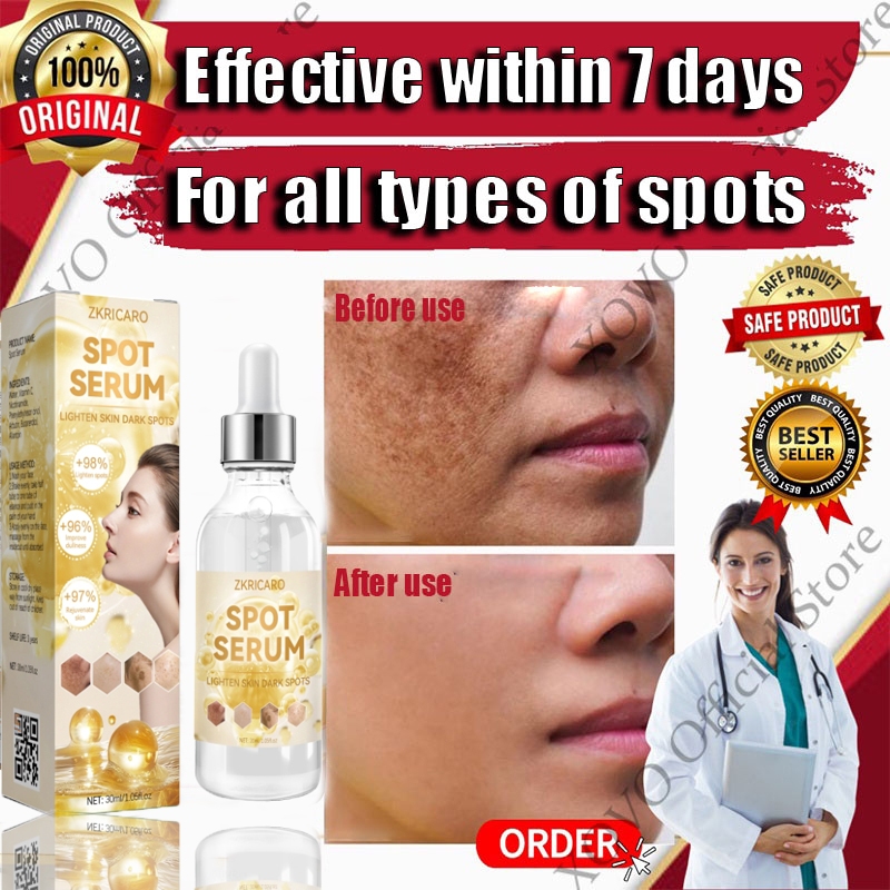 dark spot remover serum, whitening face cream, melasma serum 30ML