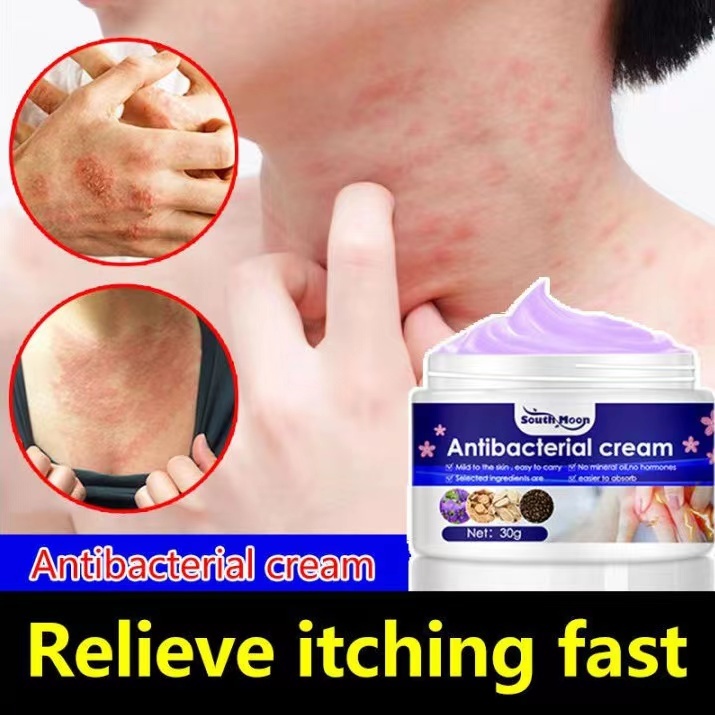 South Moon Anti Bacterial Eczema Cream Anti Itching Sweat Herpes ...