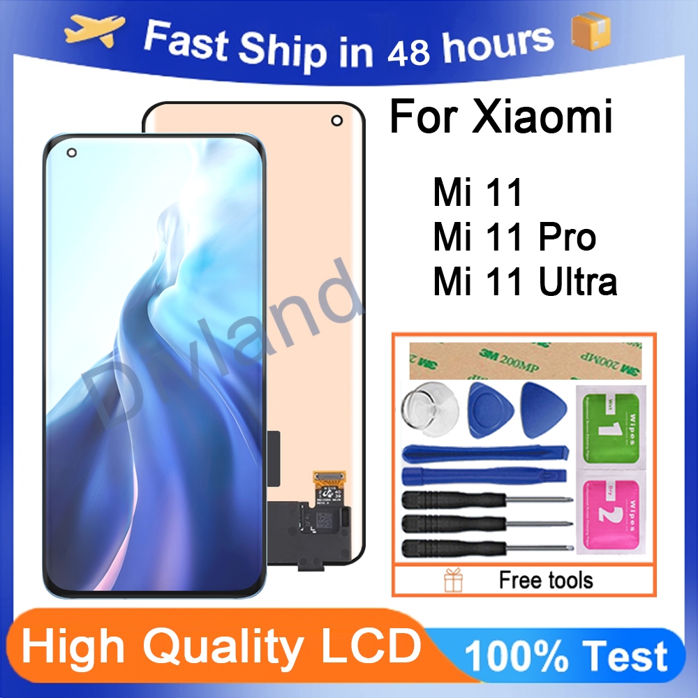 Xiaomi Mi 11 Display