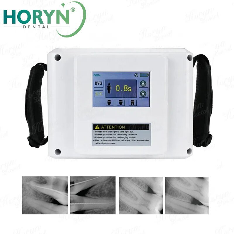 Portable Dental X Ray Camera Touch Screen Handheld Dental X Ray Unit ...