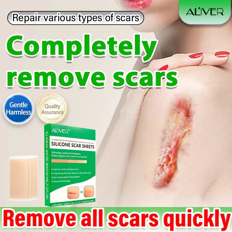 ALIVER 4Pcs/box Scar Sticker Sheets Medical Silicone Gel Strips Patch ...