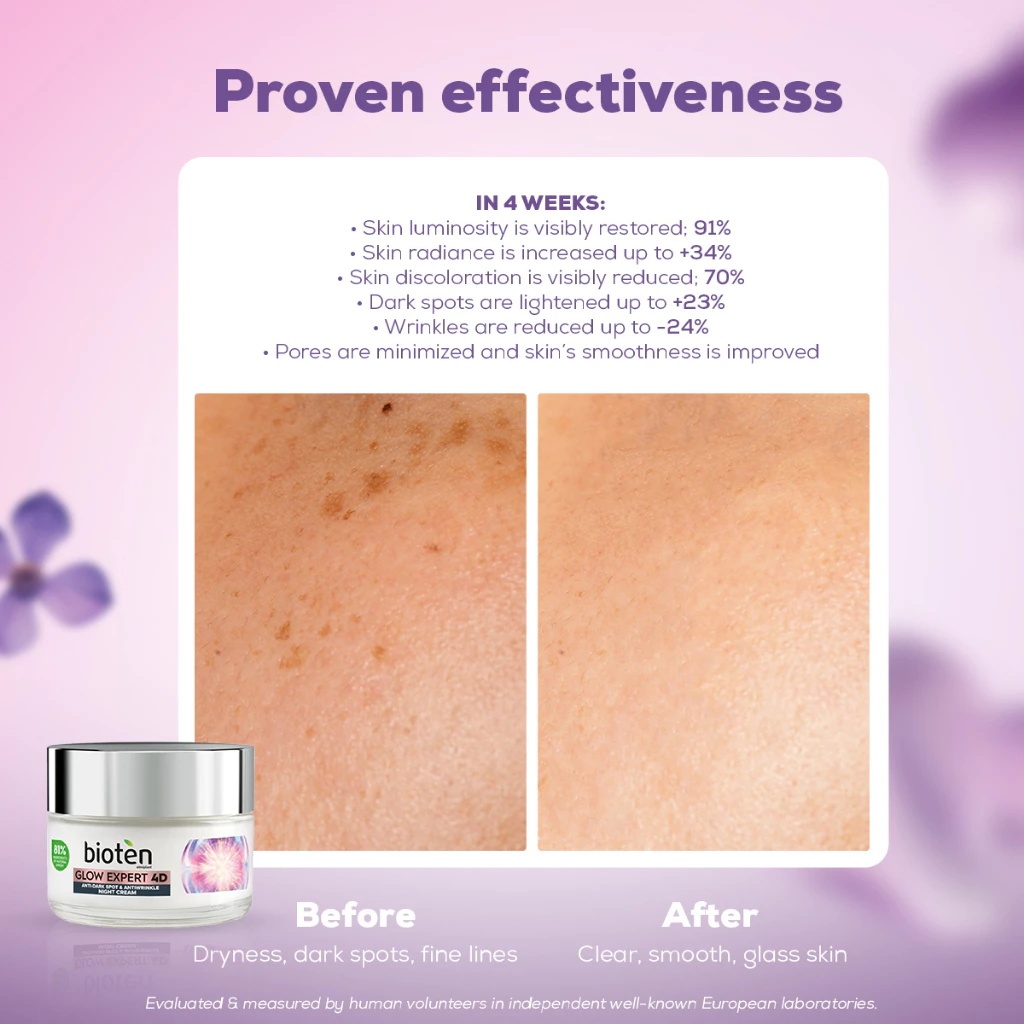 Bioten 4D Glow Expert Night Cream 50ml | Shopee Philippines