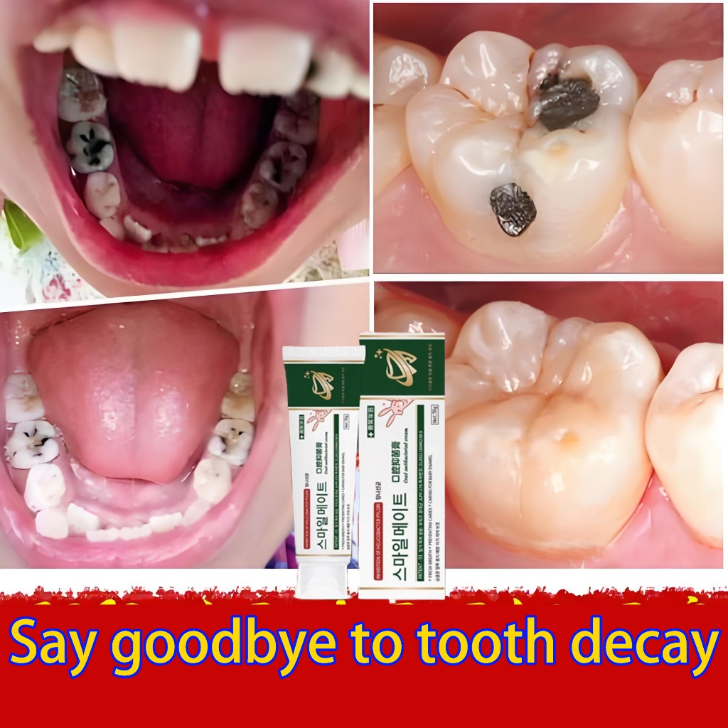 【Korean brand】Anti-caries toothpaste, deep cleaning, protect teeth ...
