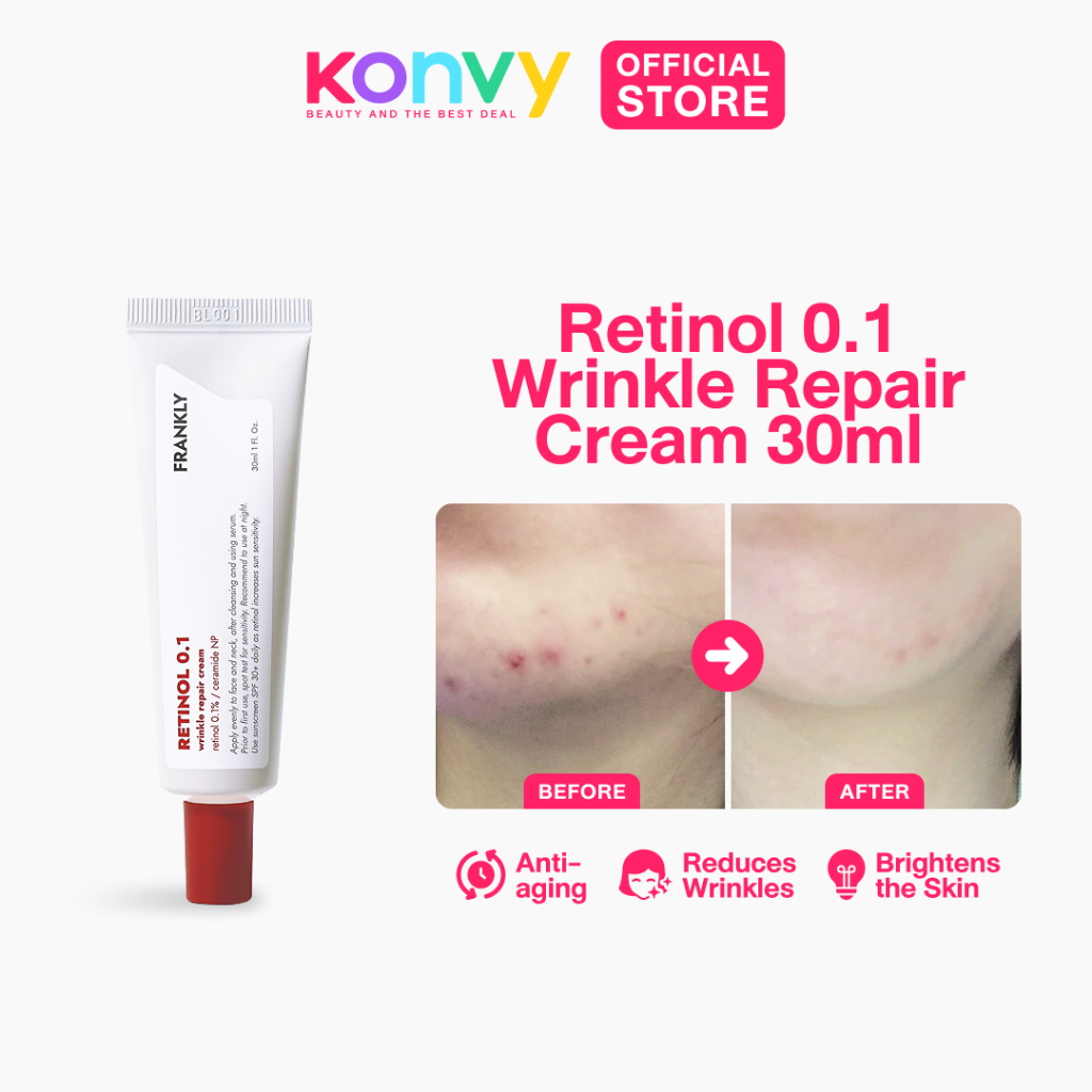 Frankly Retinol 0.1 Wrinkle Repair Cream 30ml | Shopee Philippines
